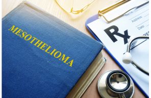 Mesothelioma Lawsuit Navigating Legal Avenues for Compensation